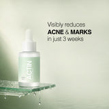 Actin Serum