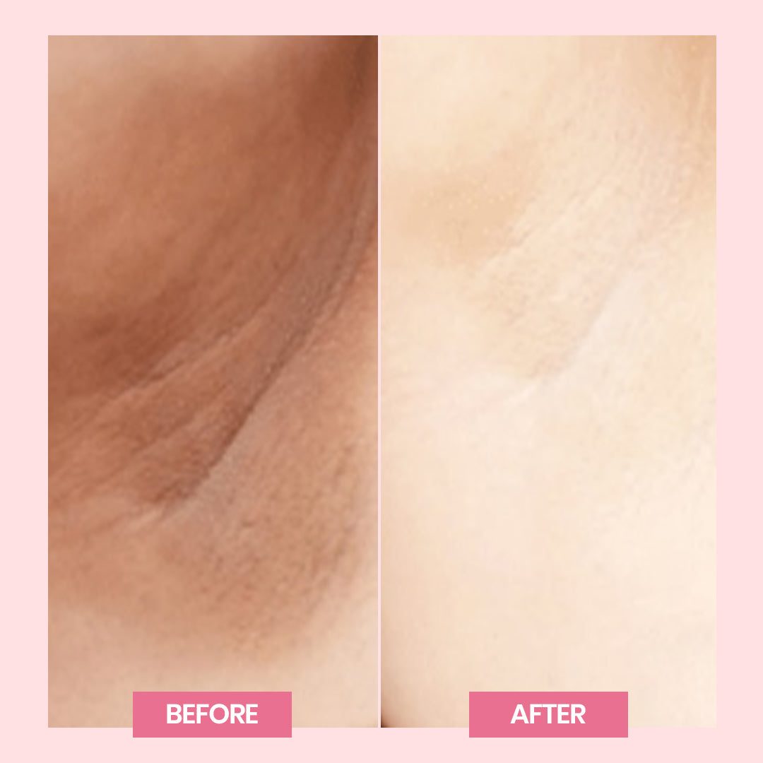 reborn cream result